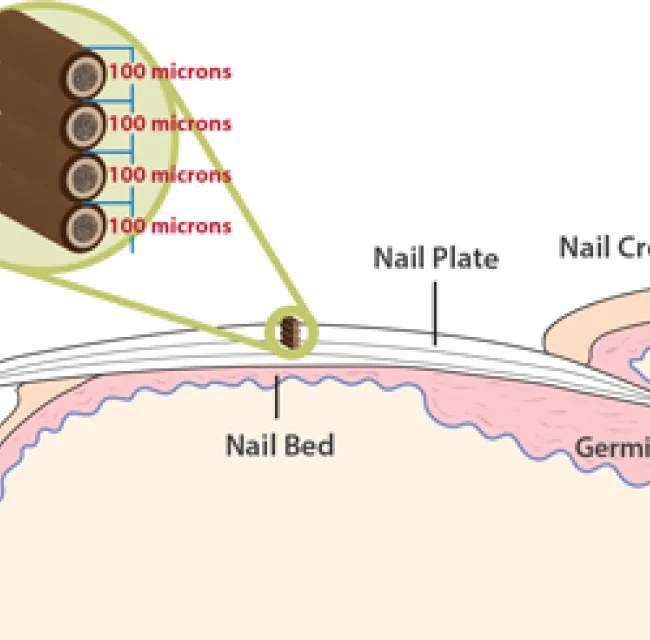 nail thickness